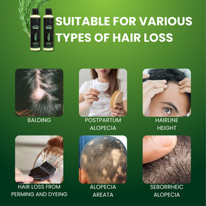 🔥Final 3 Hours: 70%OFF🔥FantasFeelets® Rosemary Hydrolyzed Keratin Shampoo