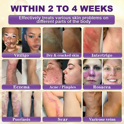 Made and Shipped from USA ✨FantasFeelets® Biotin 10-in-1 Skin Restoration Cream 🍀