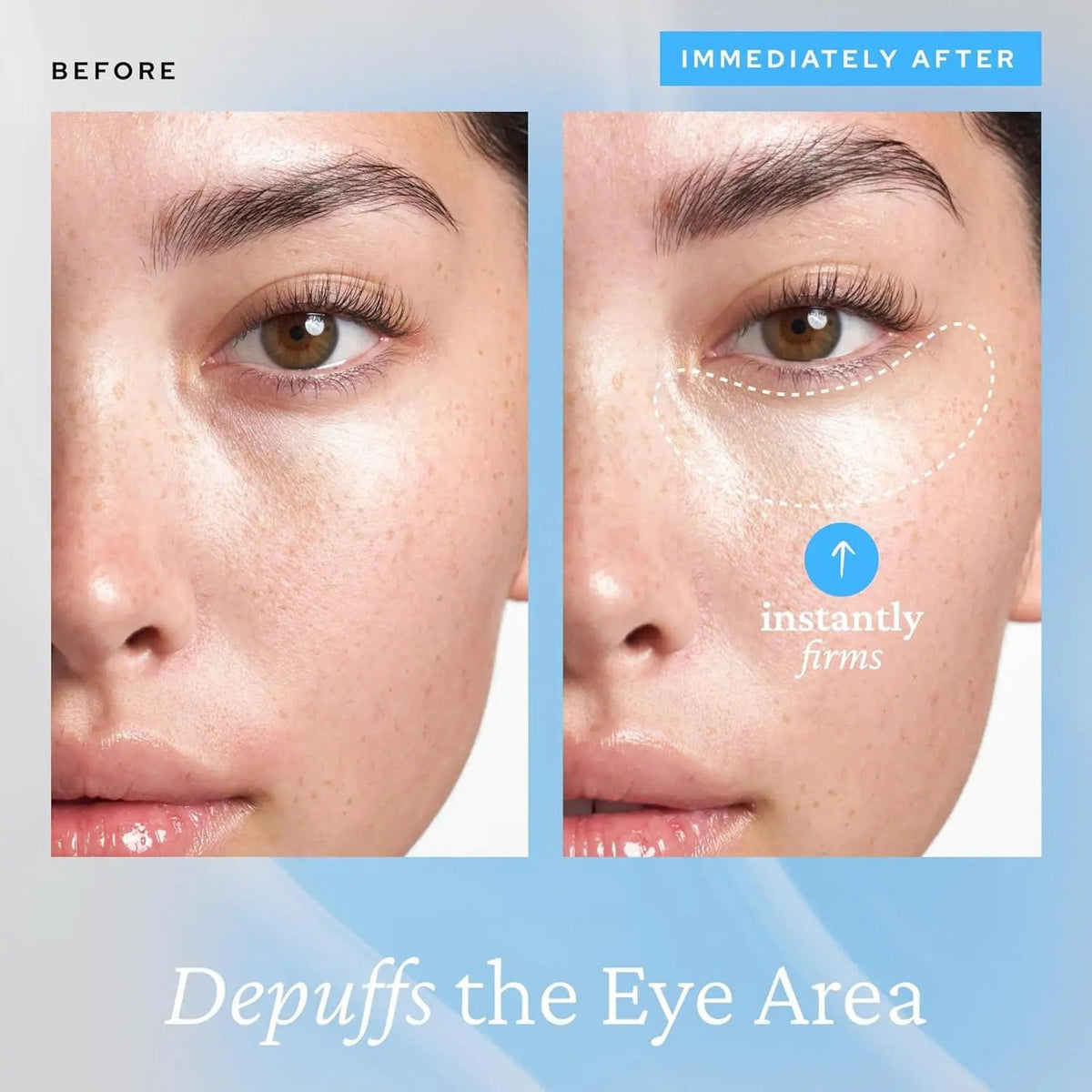 Eye Gel, Korean Skincare with Caffeine, Hyaluronic Acid & Niacinamide – Hydrating, Depuffing & Plumping Eye Cream with Cooling Ceramic Tip