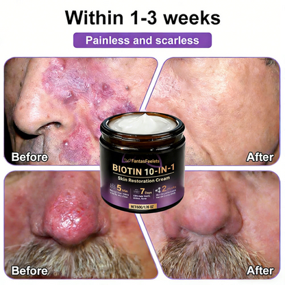 Made and Shipped from USA ✨FantasFeelets® Biotin 10-in-1 Skin Restoration Cream 🍀