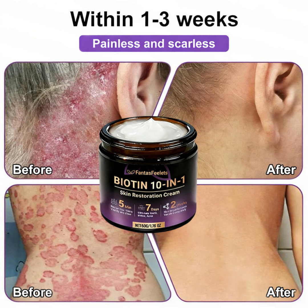 Made and Shipped from USA ✨FantasFeelets® Biotin 10-in-1 Skin Restoration Cream 🍀