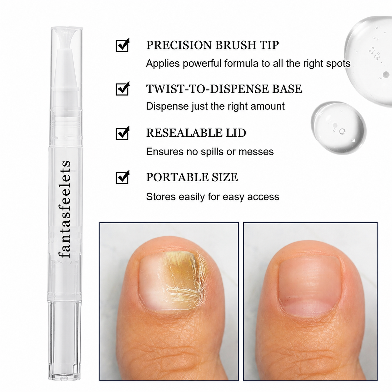 Toenail Fungus Treatment Pen for Damaged Nails