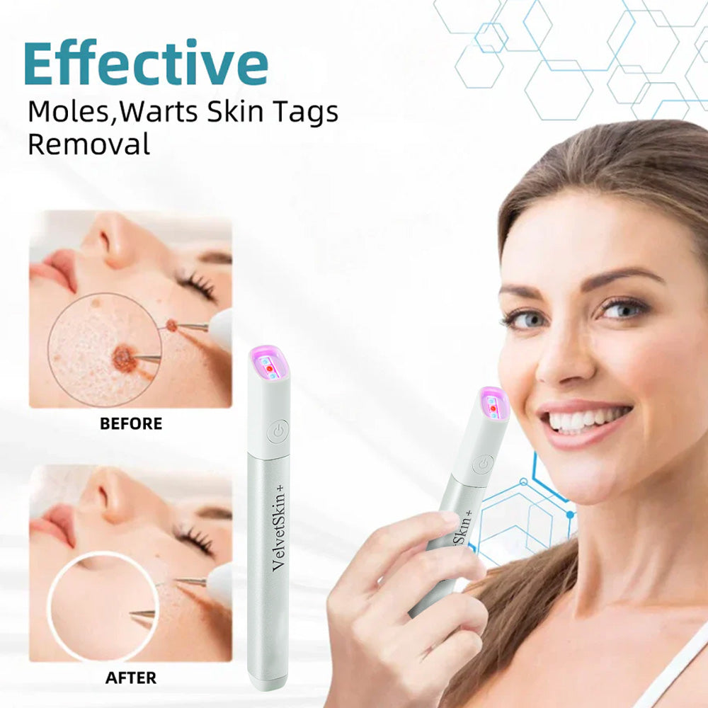 🔥 NEW 2026 GEN 2 Update☂Fantasfeelets® VelvetSkin+Series ⚔️All-in-One Laser Eraser Pen🖊️ (🔬Powered by CO₂ laser technology – effectively removes moles, warts, skin tags, pigmentation spots, and other skin imperfections)