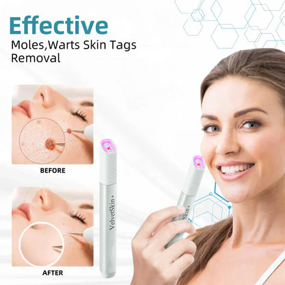 🔥 NEW 2026 GEN 2 Update☂Fantasfeelets® VelvetSkin+Series ⚔️All-in-One Laser Eraser Pen🖊️ (🔬Powered by CO₂ laser technology – effectively removes moles, warts, skin tags, pigmentation spots, and other skin imperfections)