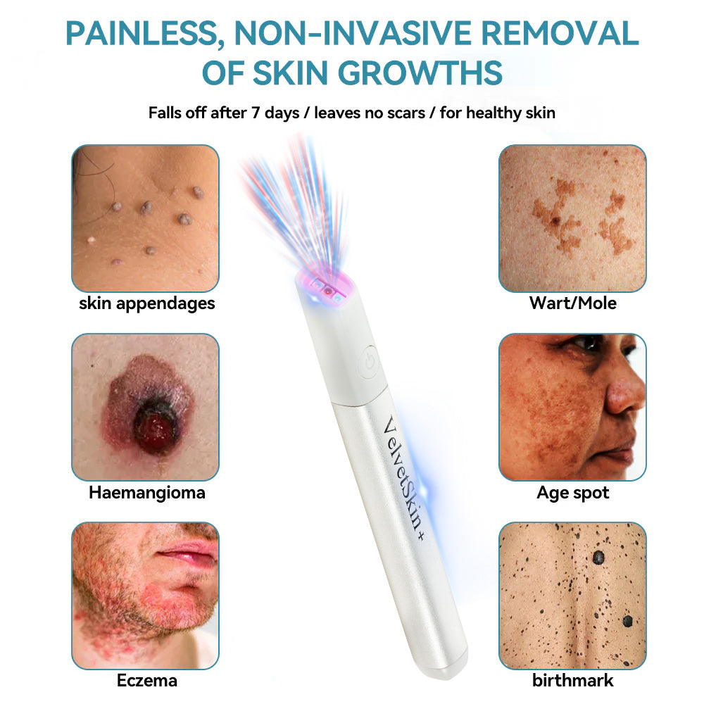 🔥 NEW 2026 GEN 2 Update☂Fantasfeelets® VelvetSkin+Series ⚔️All-in-One Laser Eraser Pen🖊️ (🔬Powered by CO₂ laser technology – effectively removes moles, warts, skin tags, pigmentation spots, and other skin imperfections)