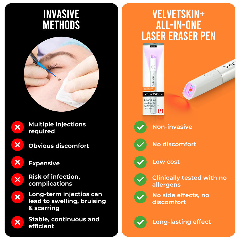 🔥 NEW 2026 GEN 2 Update☂Fantasfeelets® VelvetSkin+Series ⚔️All-in-One Laser Eraser Pen🖊️ (🔬Powered by CO₂ laser technology – effectively removes moles, warts, skin tags, pigmentation spots, and other skin imperfections)