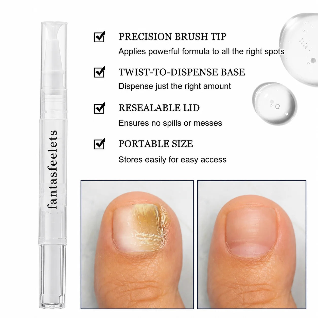 Before and after nail appearance
