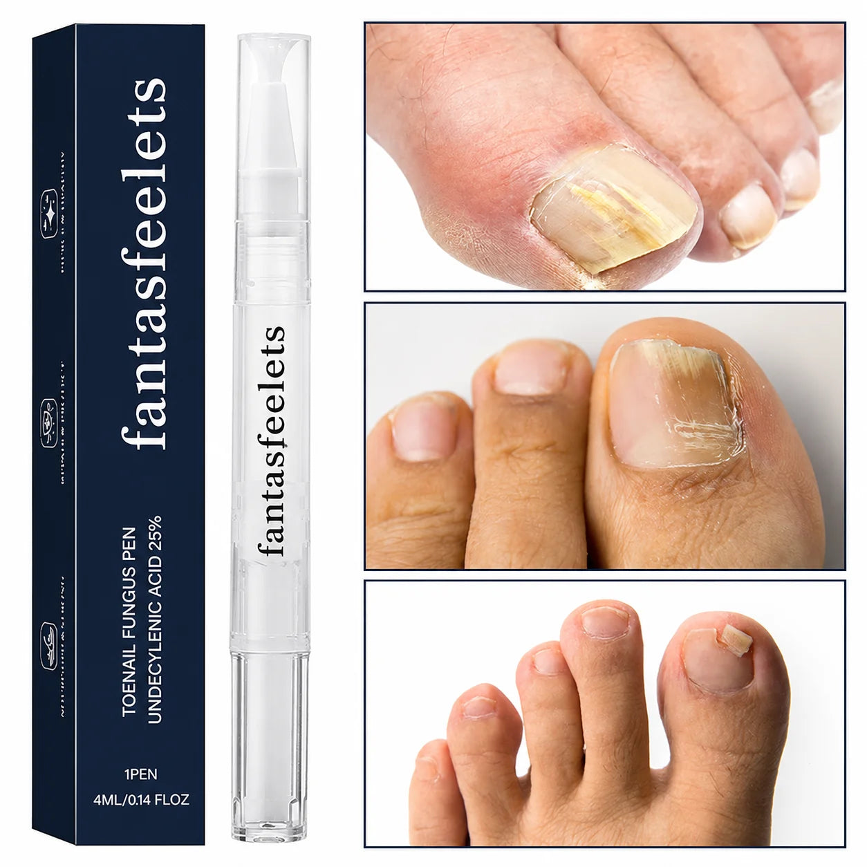 Fantasfeelets nail care pen and nail appearance